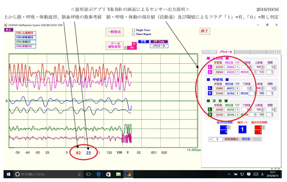 体動（脈・呼吸による凹凸）